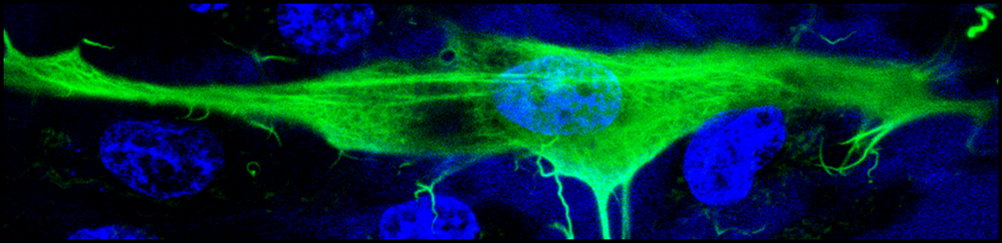 Fluorescence image of an endothelial cell