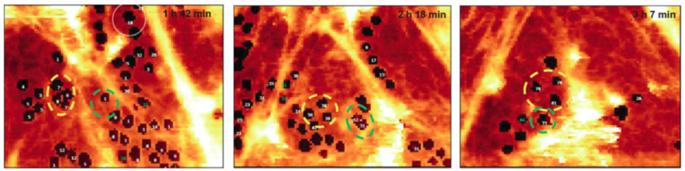 Porous structure of the selected areas of LSEC measured using 4-dimentional (x,y,z,t) AFM after 24 h from seeding on a glass slide. Available from Zapotoczny et al., Hepatology, 2019